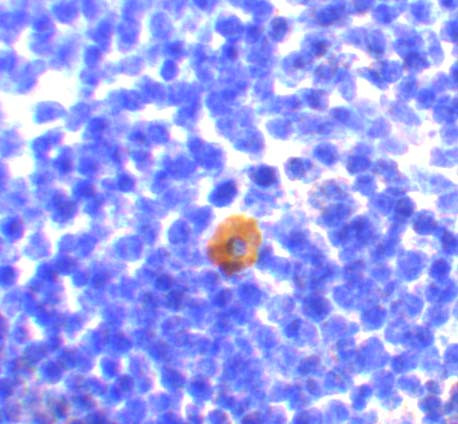 CARD11 Antibody in Immunohistochemistry (IHC)