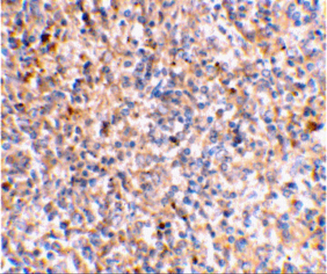 XAF1 Antibody in Immunohistochemistry (IHC)