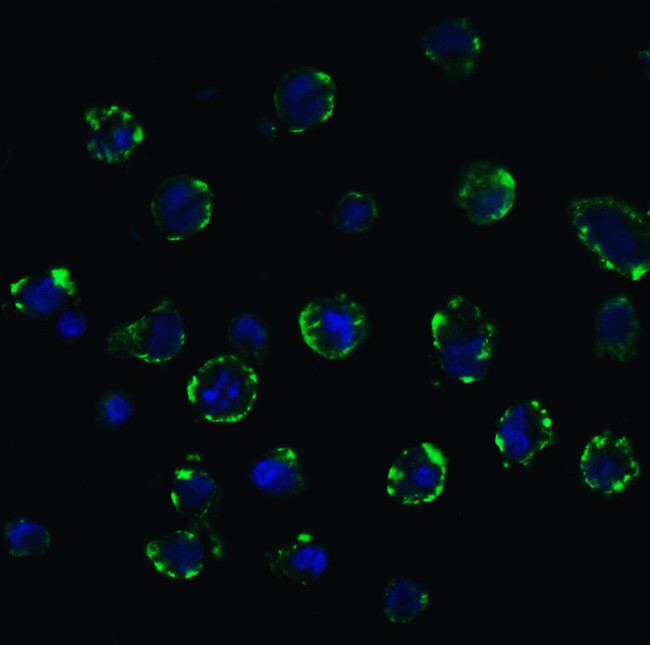 ACE2 Antibody in Immunocytochemistry (ICC/IF)