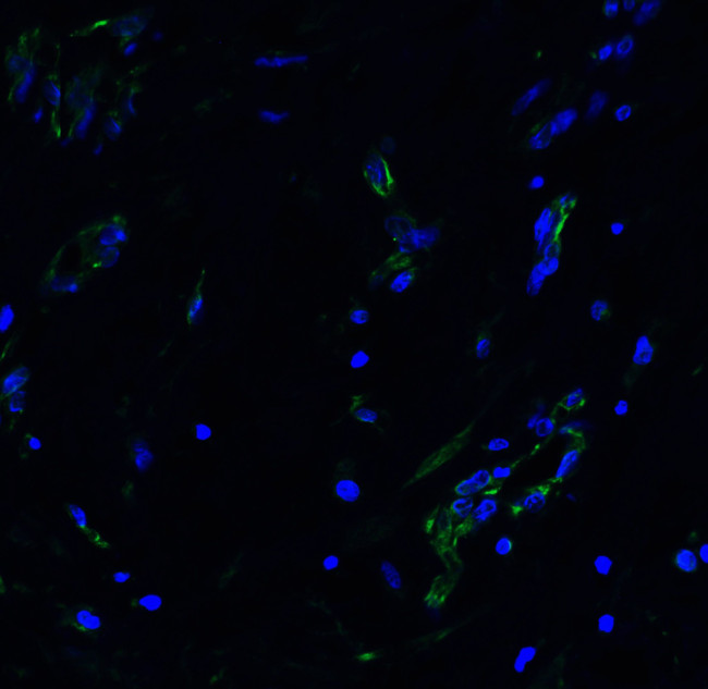 ACE2 Antibody in Immunohistochemistry (PFA fixed) (IHC (PFA))