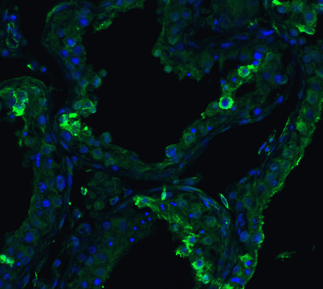 ACE2 Antibody in Immunohistochemistry (PFA fixed) (IHC (PFA))