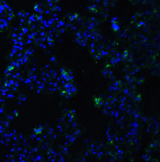 ACE2 Antibody in Immunohistochemistry (PFA fixed) (IHC (PFA))