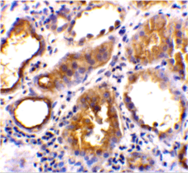 ACE2 Antibody in Immunohistochemistry (Paraffin) (IHC (P))