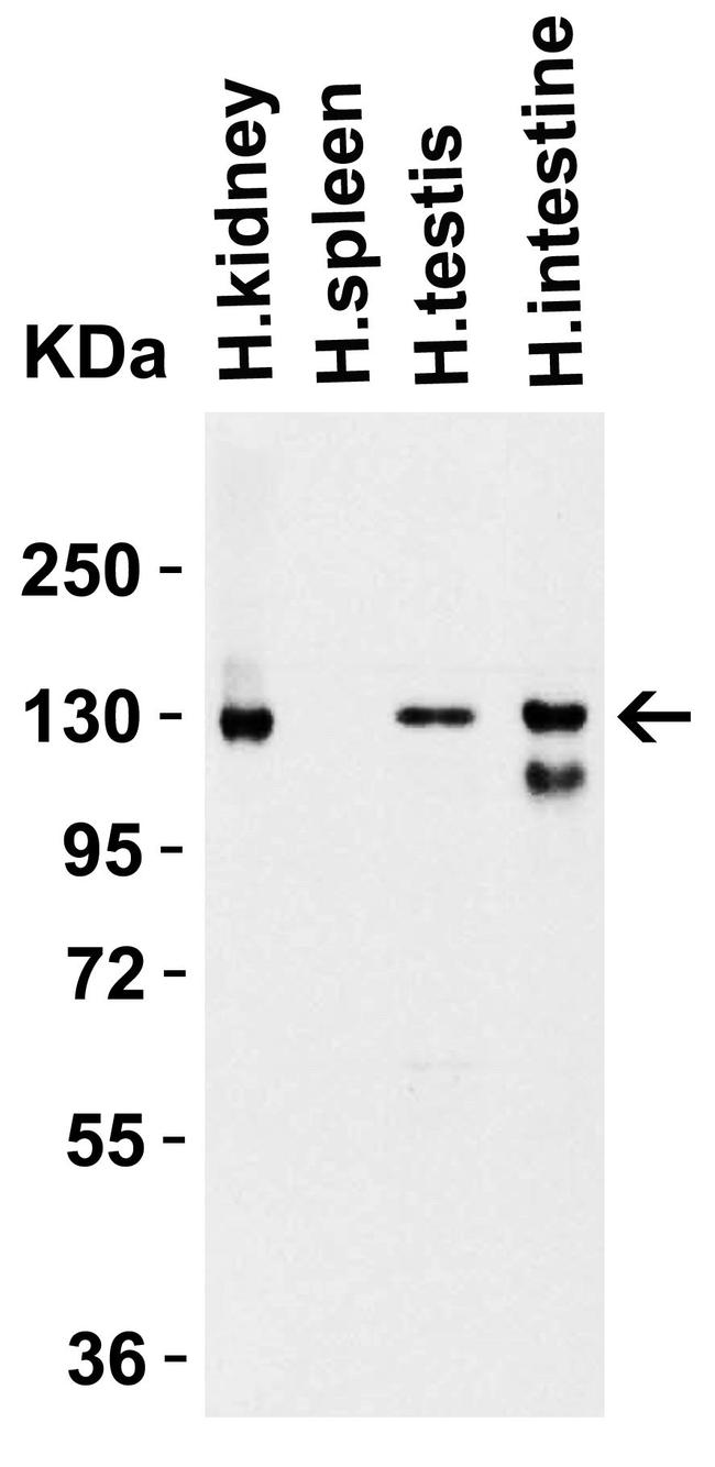 ACE2 Antibody in Western Blot (WB)