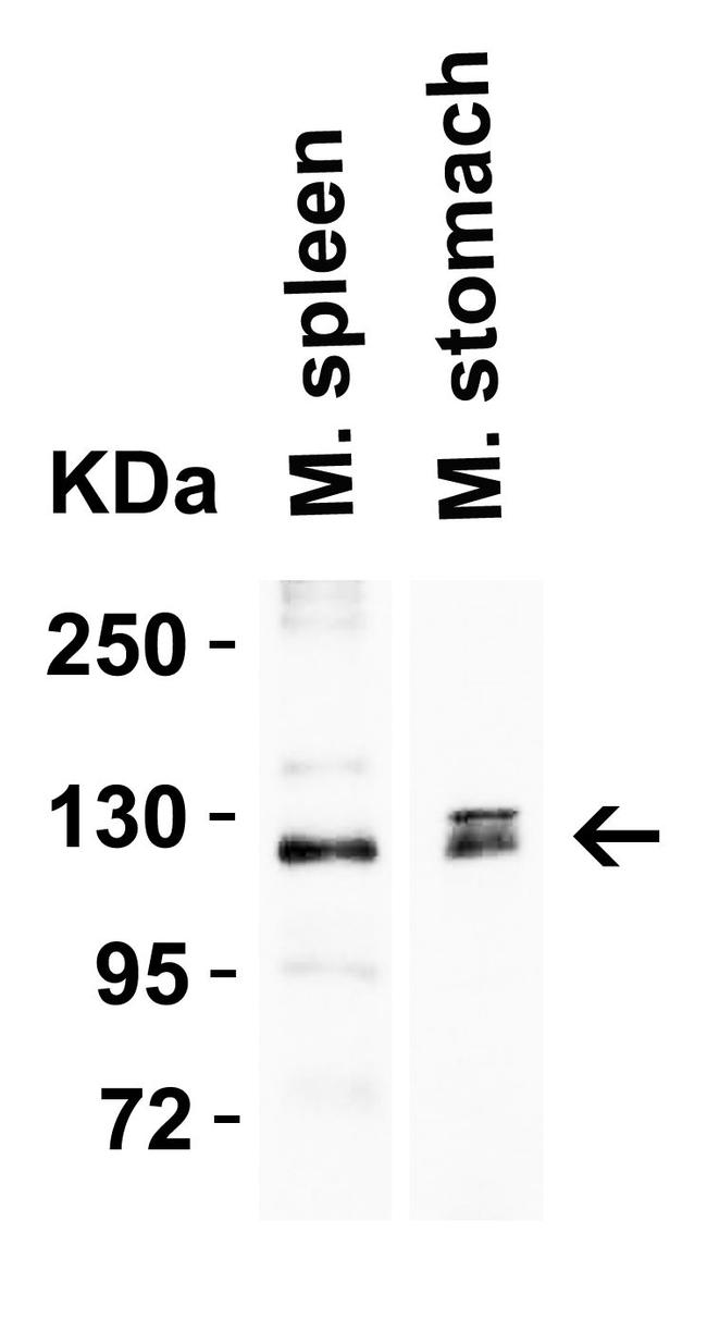 ACE2 Antibody in Western Blot (WB)