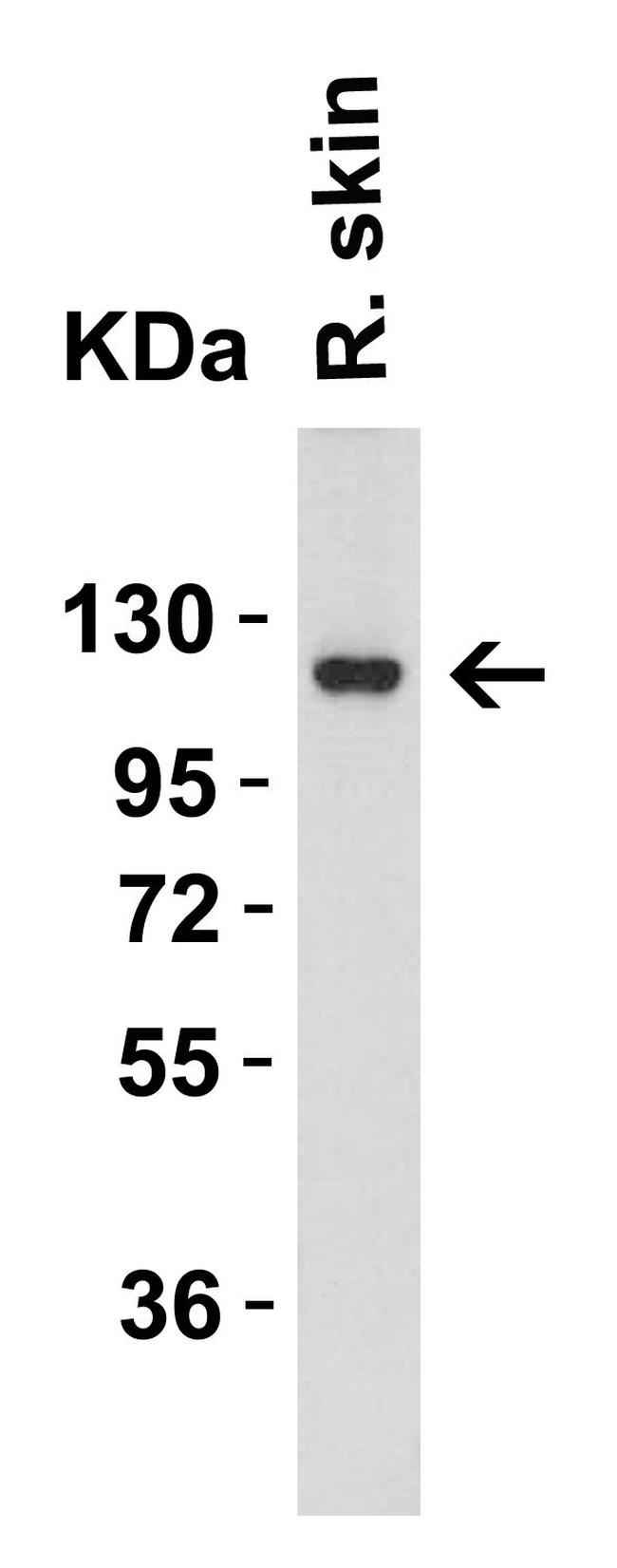 ACE2 Antibody in Western Blot (WB)