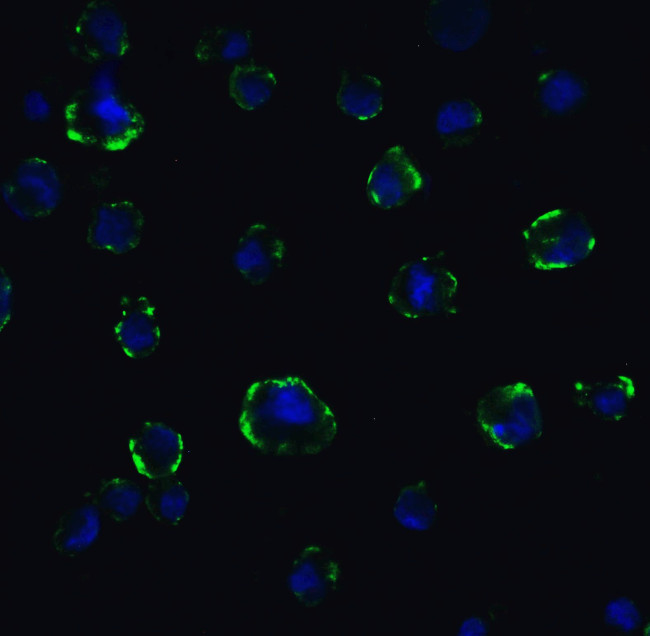 ACE2 Antibody in Immunocytochemistry (ICC/IF)