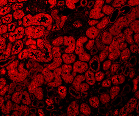 ACE2 Antibody in Immunohistochemistry (PFA fixed) (IHC (PFA))