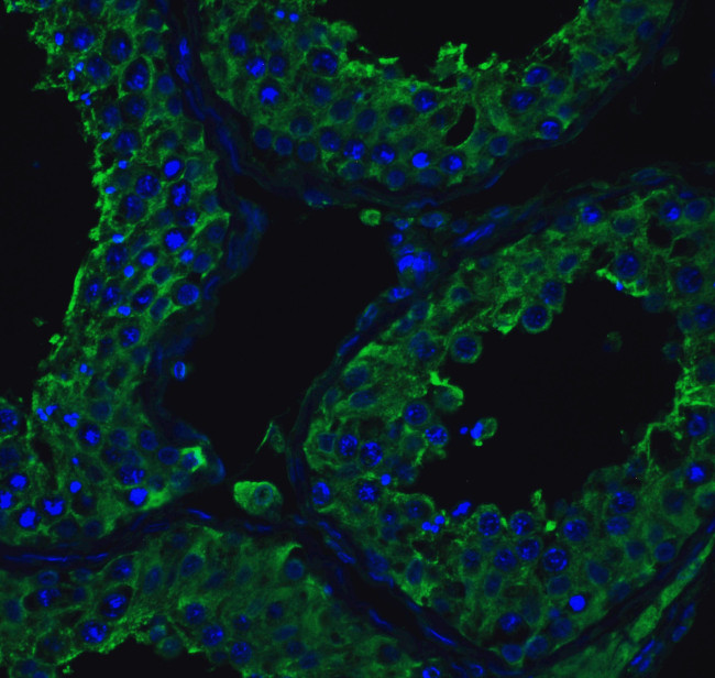 ACE2 Antibody in Immunohistochemistry (PFA fixed) (IHC (PFA))