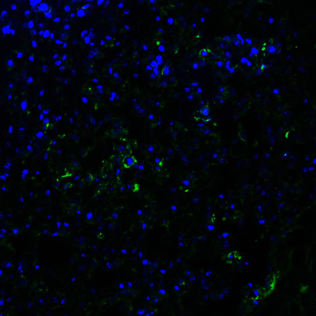 ACE2 Antibody in Immunohistochemistry (PFA fixed) (IHC (PFA))