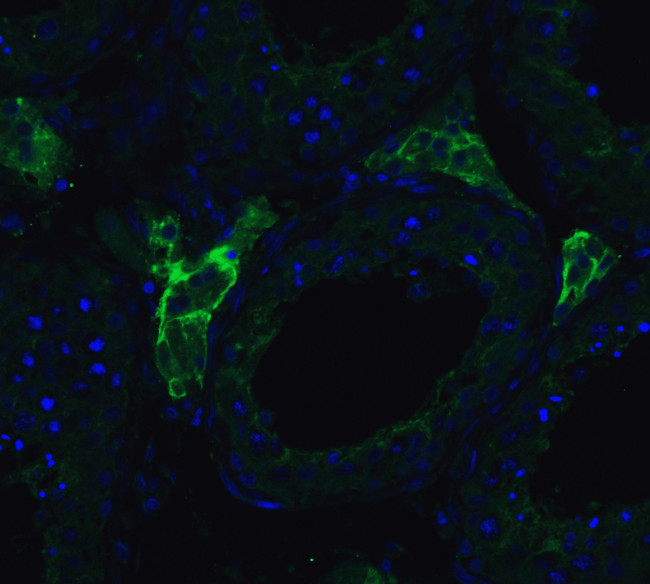 ACE2 Antibody in Immunohistochemistry (PFA fixed) (IHC (PFA))