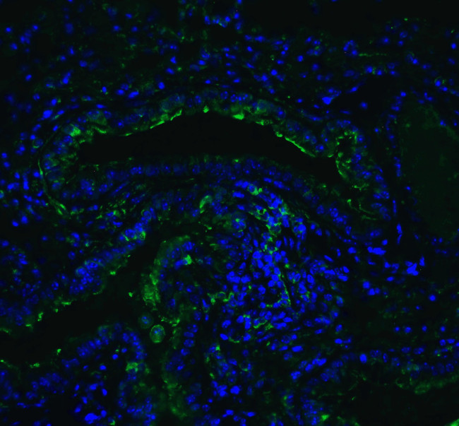 ACE2 Antibody in Immunohistochemistry (PFA fixed) (IHC (PFA))