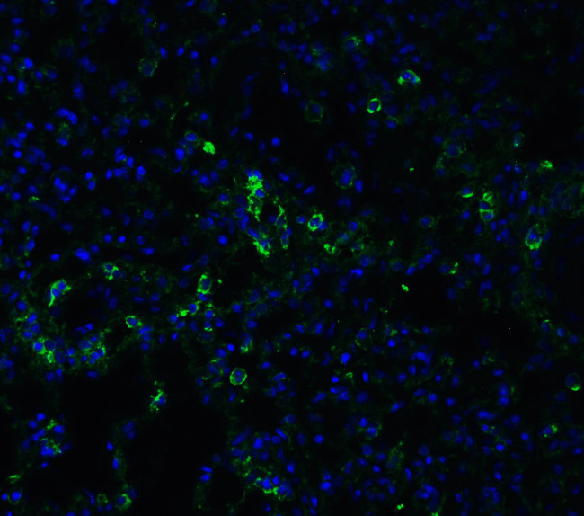 ACE2 Antibody in Immunohistochemistry (PFA fixed) (IHC (PFA))