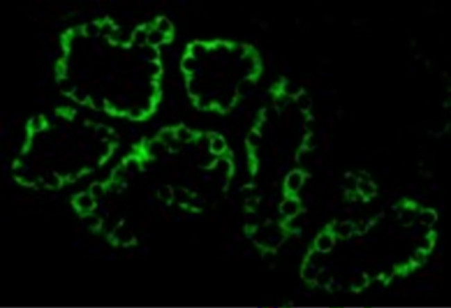 ACE2 Antibody in Immunocytochemistry (ICC/IF)