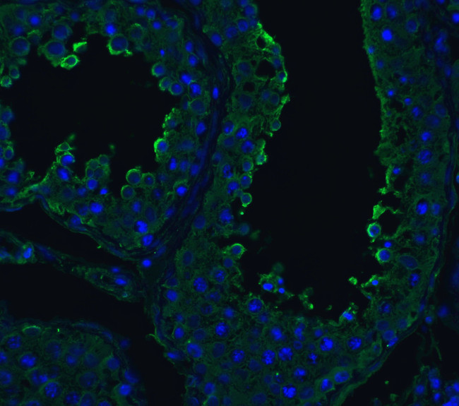 ACE2 Antibody in Immunohistochemistry (PFA fixed) (IHC (PFA))