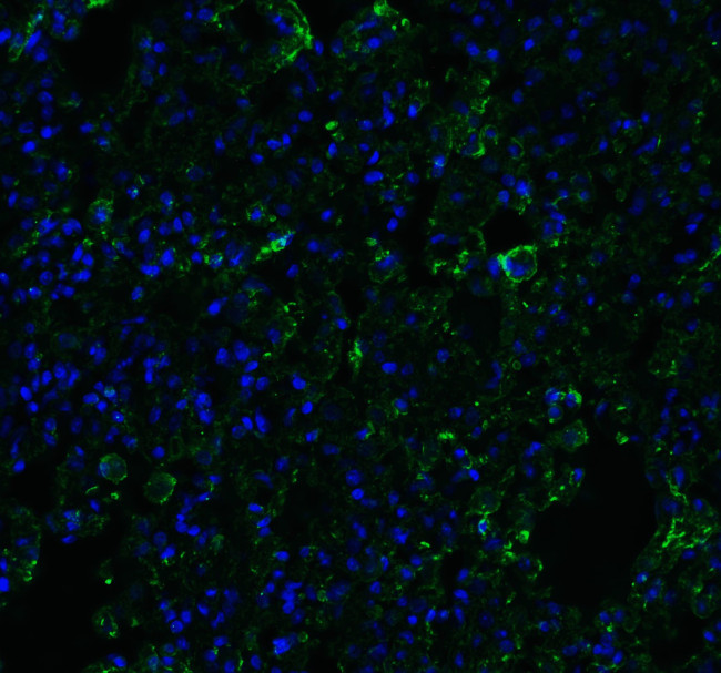 ACE2 Antibody in Immunohistochemistry (PFA fixed) (IHC (PFA))