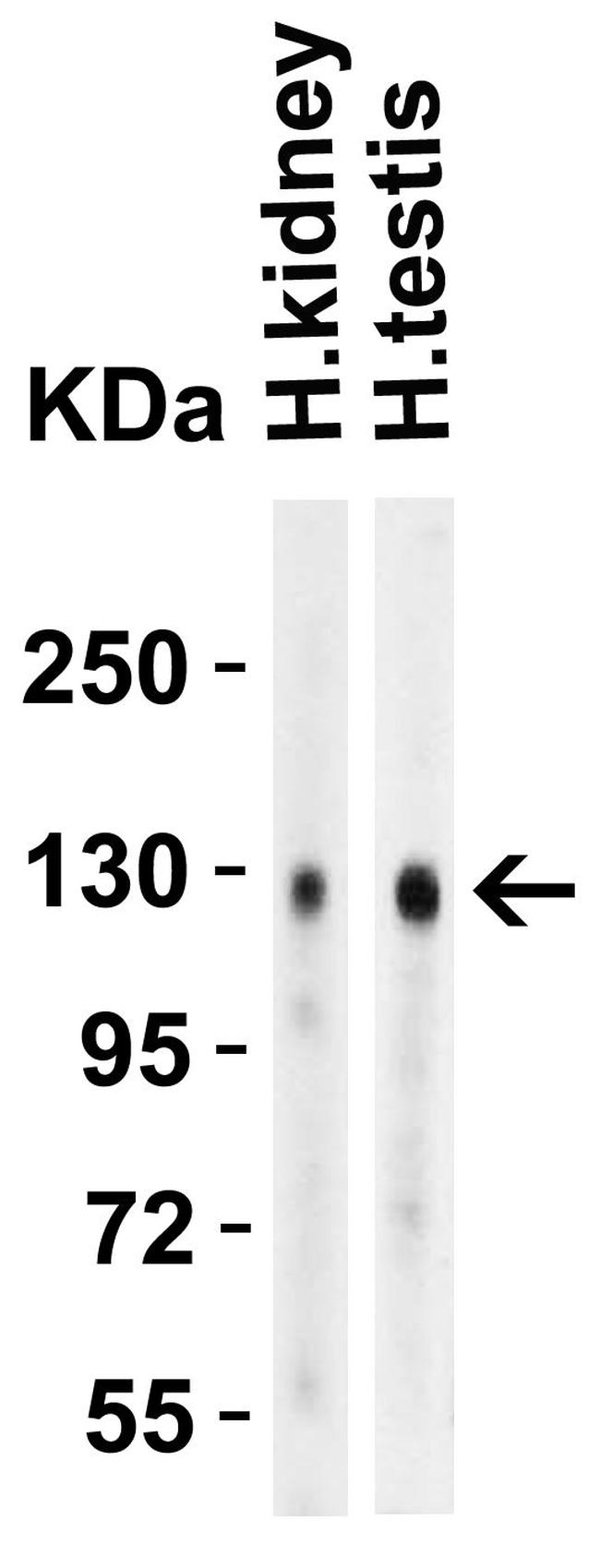 ACE2 Antibody in Western Blot (WB)