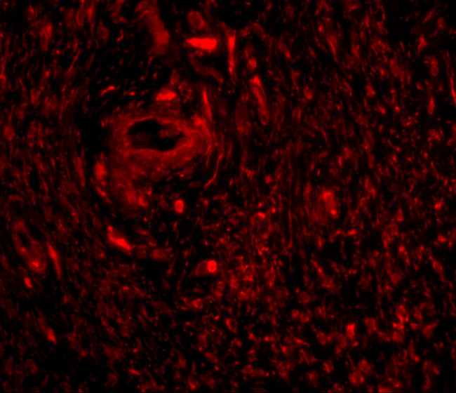 TRIM5 gamma Antibody in Immunohistochemistry (IHC)