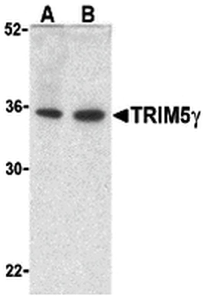 TRIM5 gamma Antibody in Western Blot (WB)