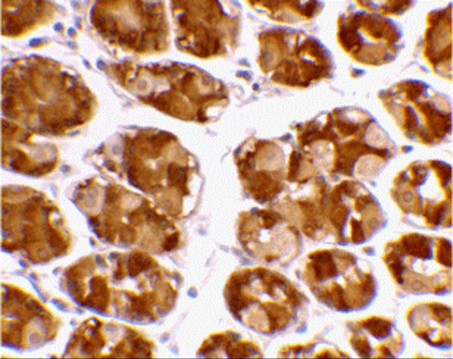 TRIM5 alpha Antibody in Immunohistochemistry (IHC)