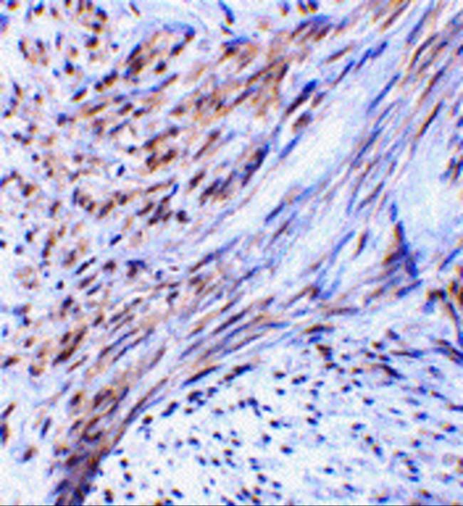 TRIM5 alpha Antibody in Immunohistochemistry (IHC)