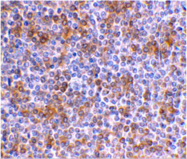 APOBEC3G Antibody in Immunohistochemistry (IHC)