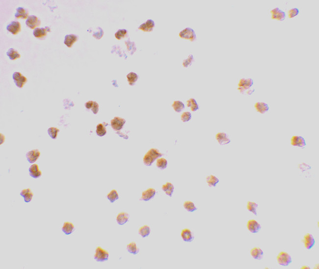 TLR7 Antibody in Immunocytochemistry (ICC/IF)