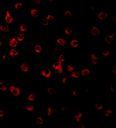 TLR11 Antibody in Immunocytochemistry (ICC/IF)