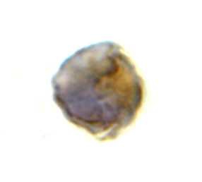 TLR8 Antibody in Immunocytochemistry (ICC/IF)