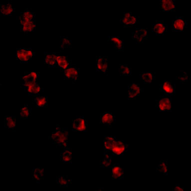 TLR8 Antibody in Immunocytochemistry (ICC/IF)