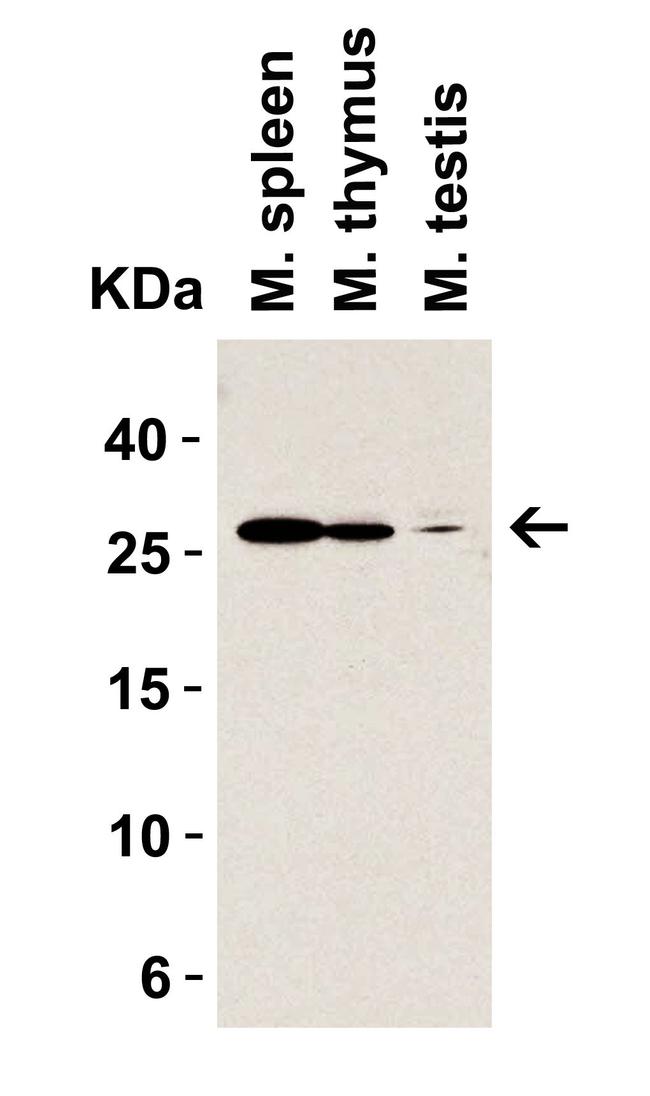 MD-2 Antibody in Western Blot (WB)