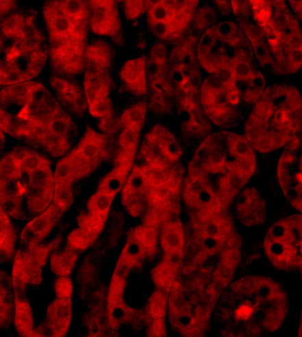 TICAM2 Antibody in Immunocytochemistry (ICC/IF)