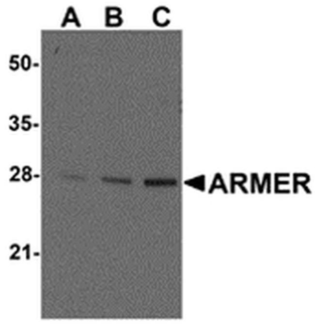 ARMER Antibody in Western Blot (WB)