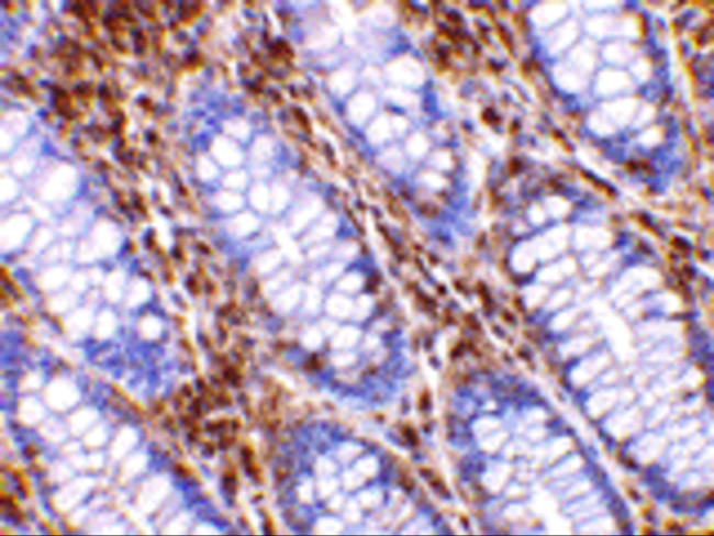 HTRA2 Antibody in Immunohistochemistry (IHC)