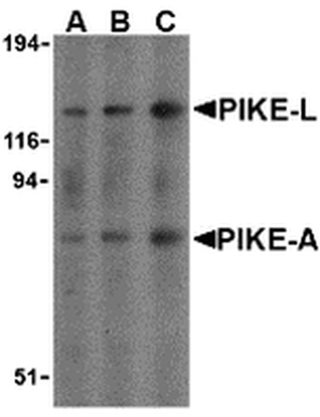 CENTG1 Antibody in Western Blot (WB)