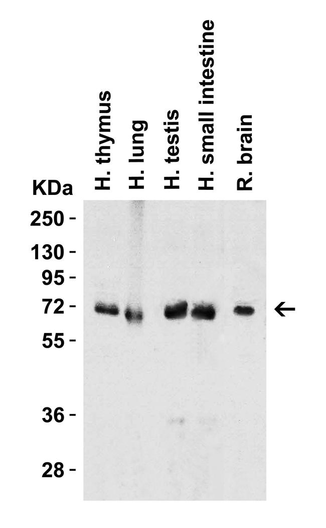 cIAP1 Antibody in Western Blot (WB)