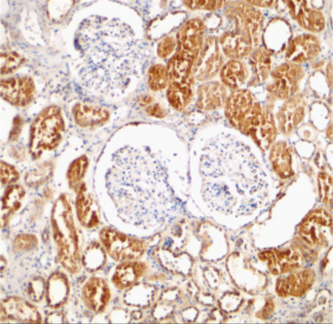 XIAP Antibody in Immunohistochemistry (IHC)