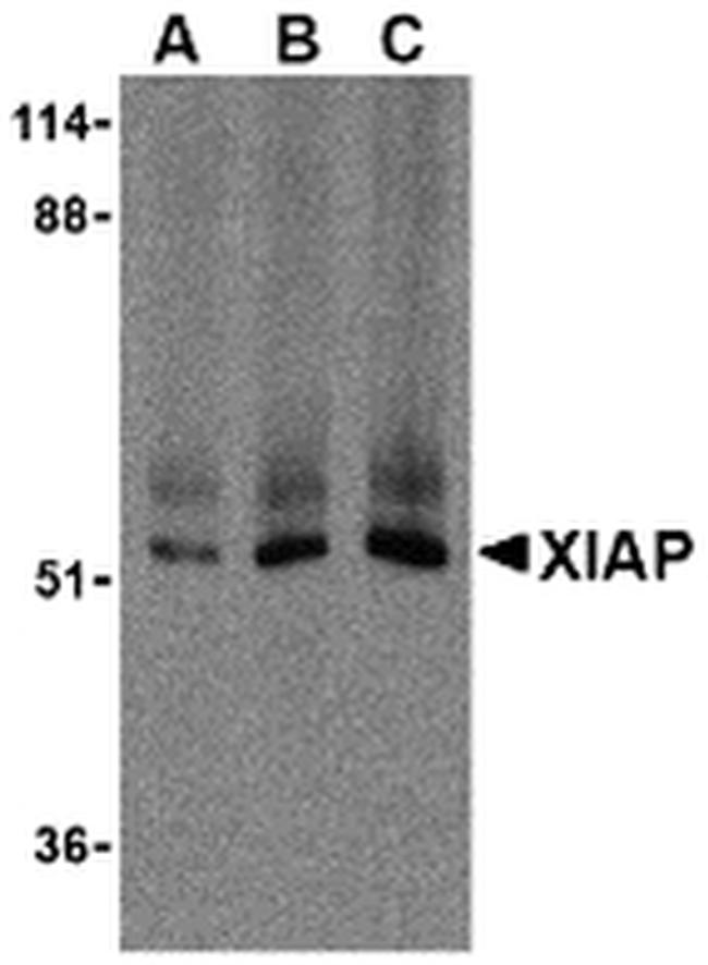 XIAP Antibody in Western Blot (WB)