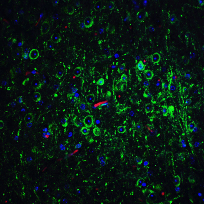 Bcl-2 Antibody in Immunohistochemistry (Paraffin) (IHC (P))