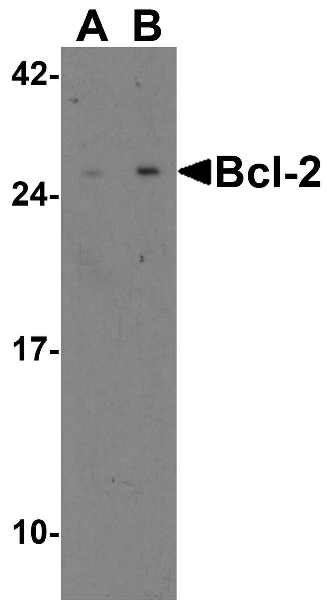 Bcl-2 Antibody in Western Blot (WB)