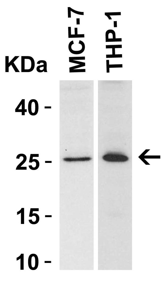 Bcl-2 Antibody in Western Blot (WB)