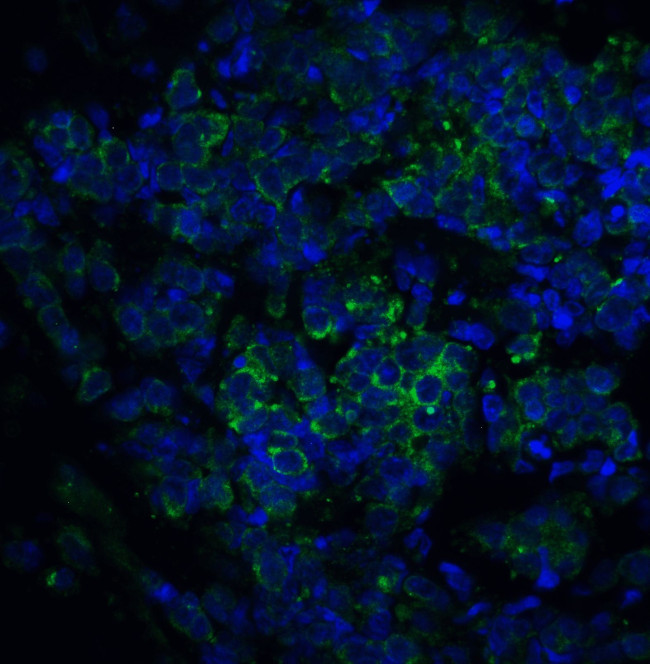 ST2 Antibody in Immunohistochemistry (IHC)