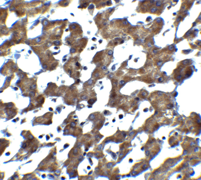 ST2 Antibody in Immunohistochemistry (IHC)