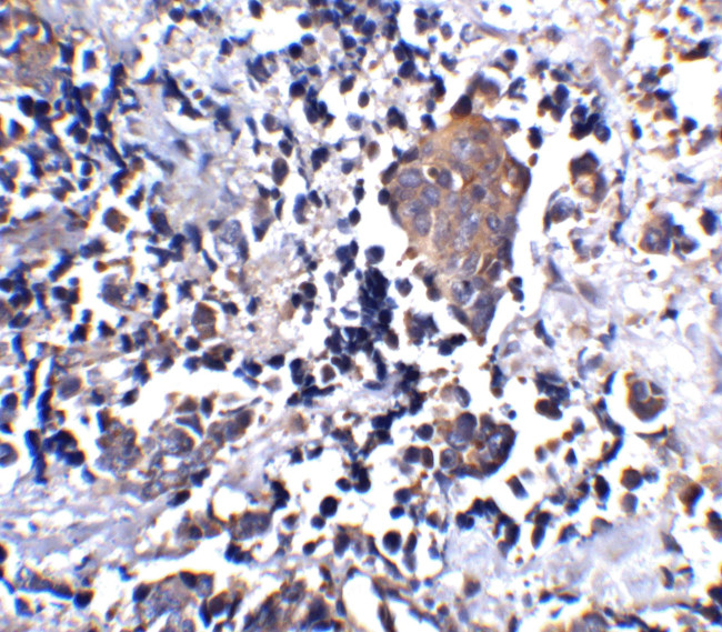 ST2 Antibody in Immunohistochemistry (IHC)