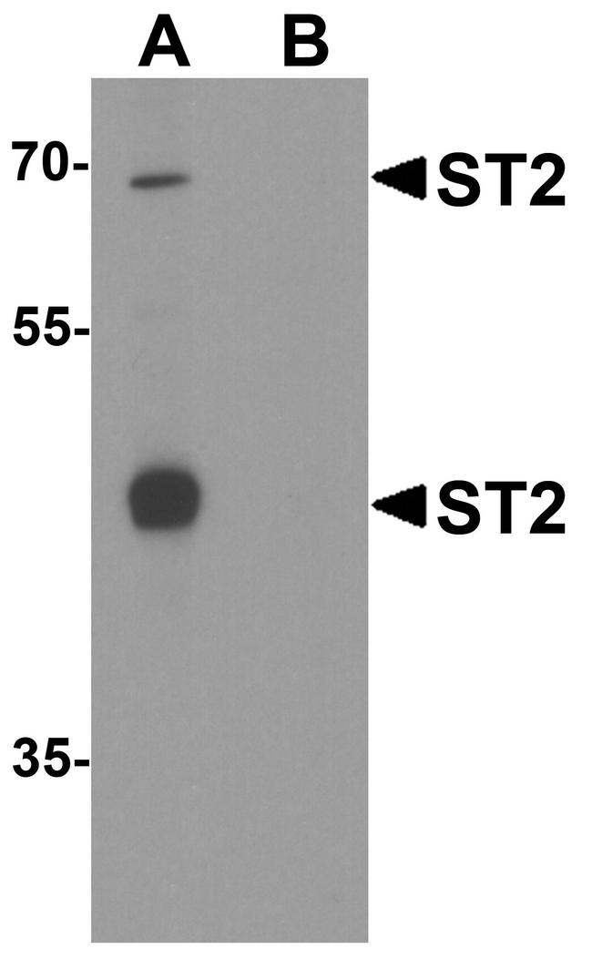 ST2 Antibody in Western Blot (WB)