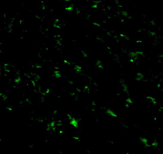 RNF216 Antibody in Immunocytochemistry (ICC/IF)