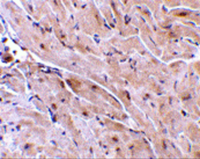 RNF216 Antibody in Immunohistochemistry (IHC)