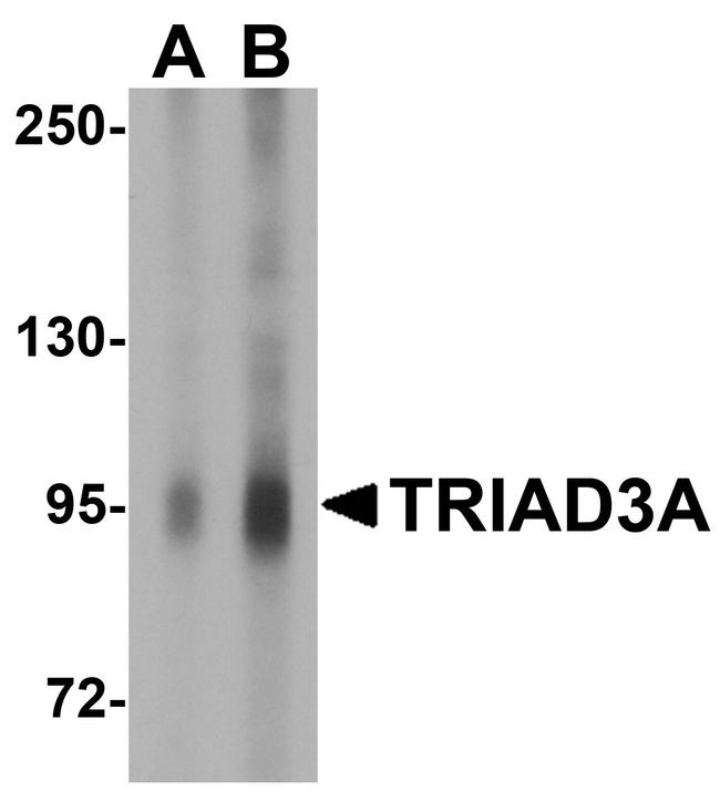 RNF216 Antibody in Western Blot (WB)