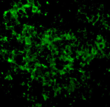 UBC13 Antibody in Immunocytochemistry (ICC/IF)