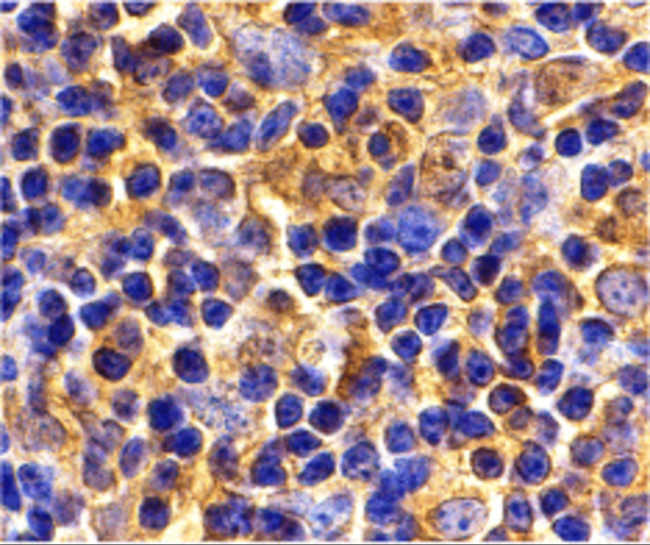 UBC13 Antibody in Immunohistochemistry (IHC)